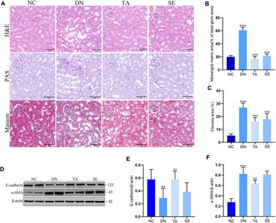 Thonningianin A ameliorated renal interstitial fibrosis in diabetic nephropathy mice by modulating gut microbiota dysbiosis and repressing inflammation